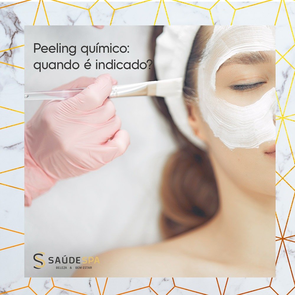 Peeling químico: quando é indicado?