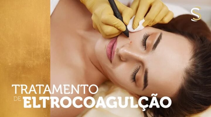 Tratamento de Eletrocoagulação