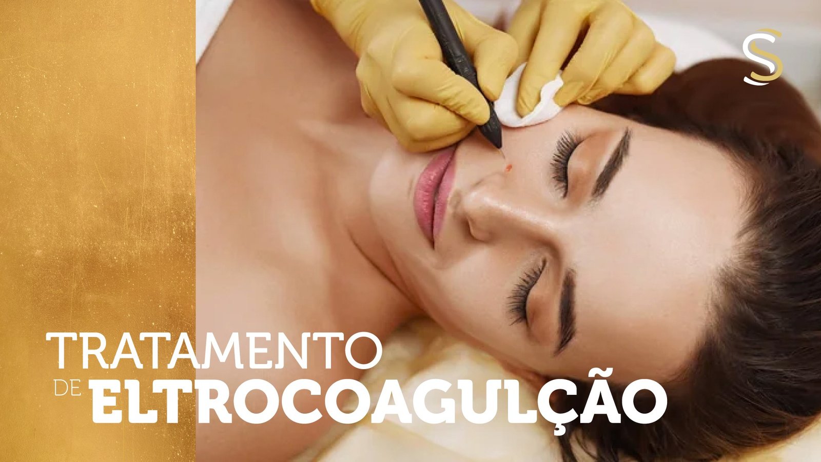 Tratamento de Eletrocoagulação