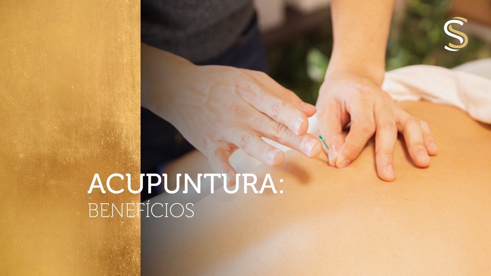 Acupuntura
