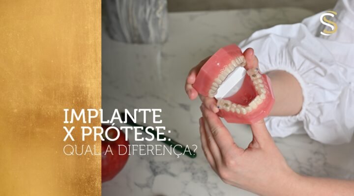 Implante X Prótese: qual a diferença?